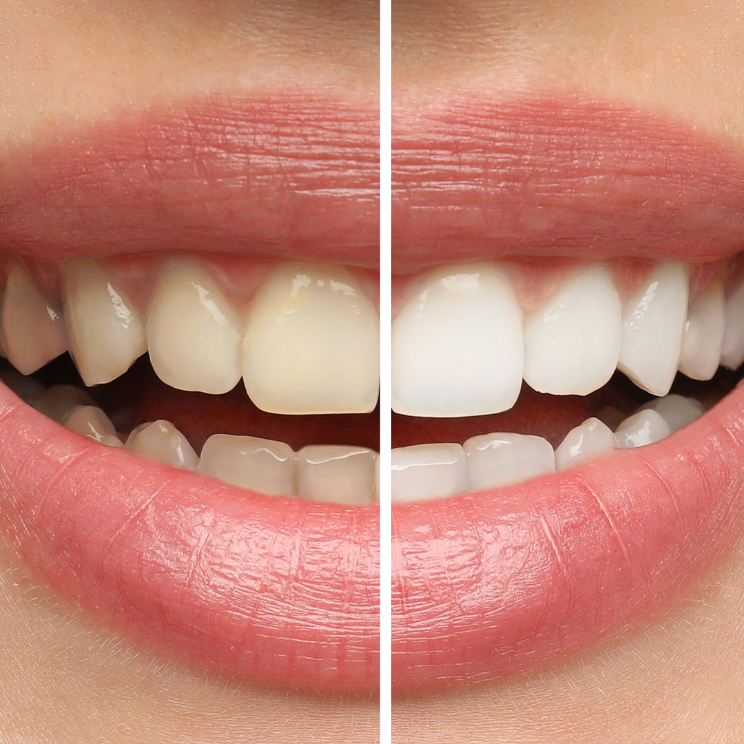 Complete Family Dentistry | Dentures, Extractions and Dental Fillings